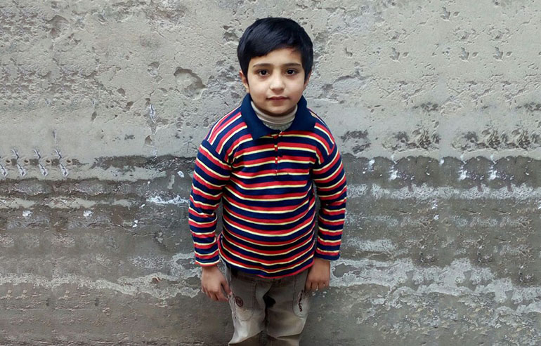 M. Faizan PreOpa Pics (3)