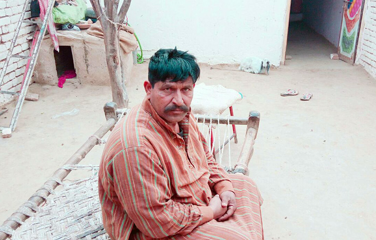 Muhammad Akram PreOp Pics aa (1)