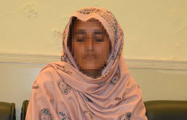 Saeeda Begum Abbasi Preop Pics a (4)