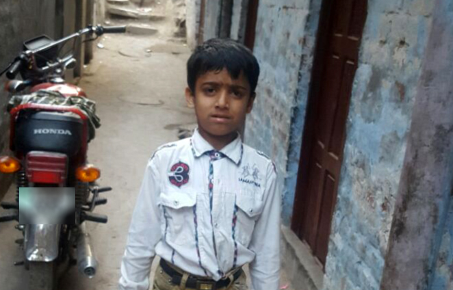 M. Haseeb PreOp Pics a (2)