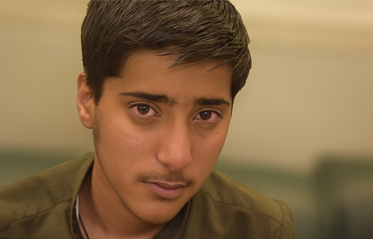 M. Kashif PreOp Pics Office a (4)