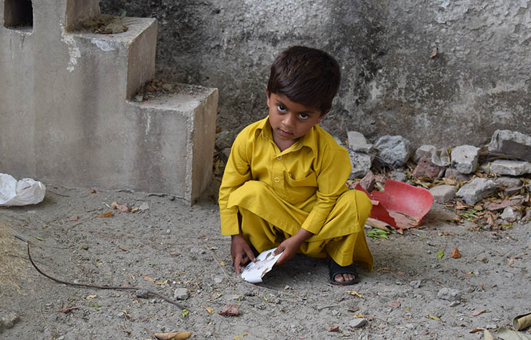M. Ramzan PreOp Pics a (12)