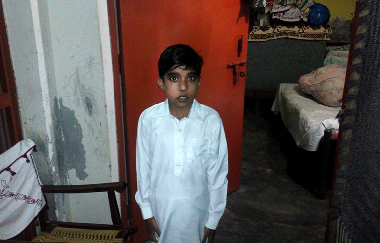 Sohail Ahmed PreOp Pics (3s)