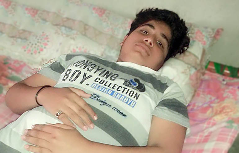 Usama Ijaz PreOp