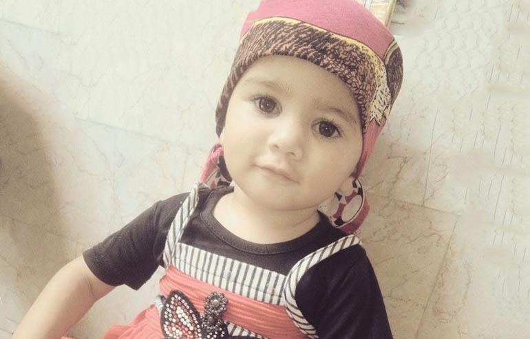 Dua Fatima PreOp Pics a (2)