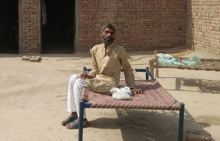 Muhammad Jamil PreOp pics (1) 11