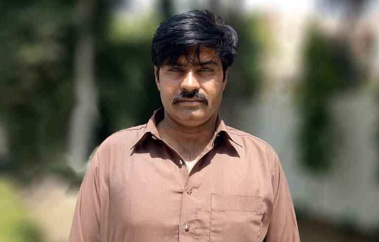 Faqeer Hussain PreOp Pics (2) aa