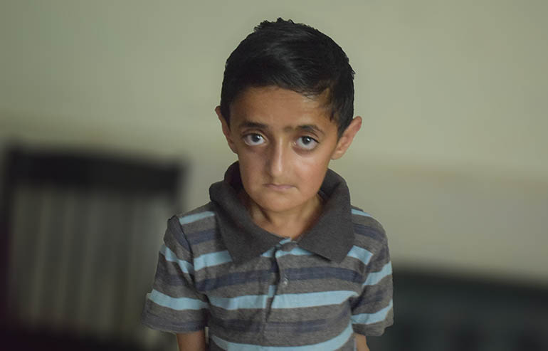 Hamza Razzaq PreOp pics (4)