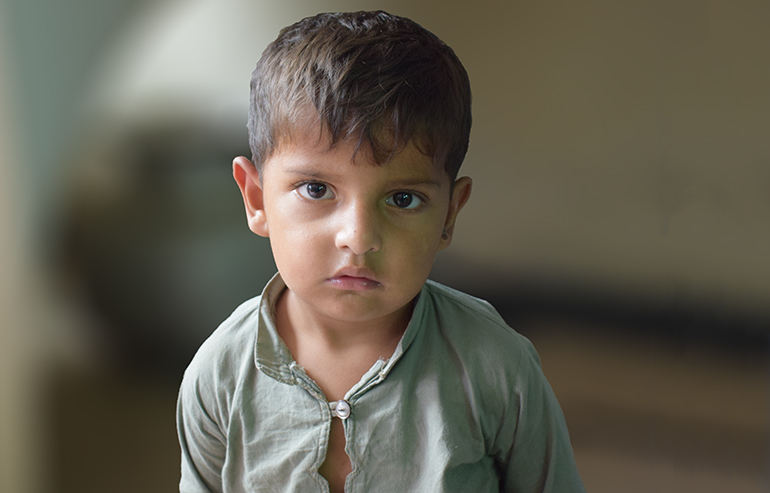 Abdul Hadi PreOp Pics (8) aa