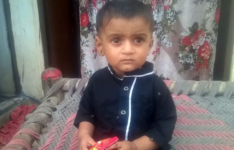 M. Azeem PreOP Pics (27) aaa