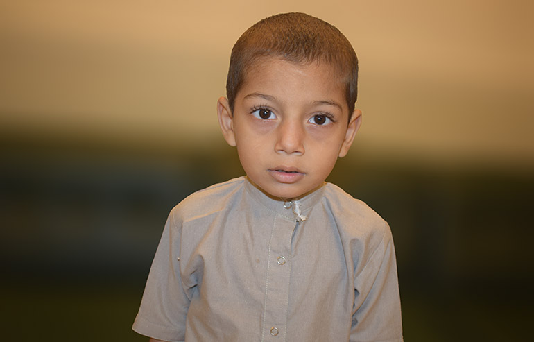 Faizan Abbas PreOp pics (8)aa