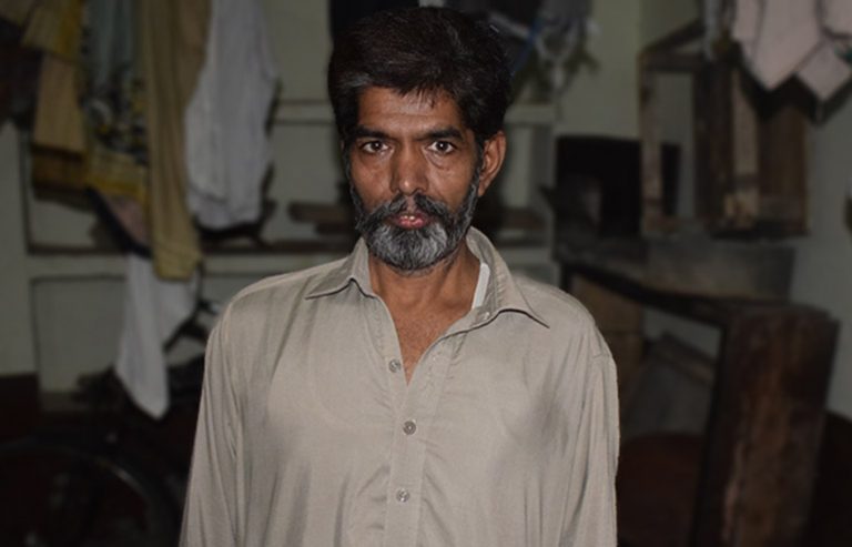 Muhammad Anwar PreOp Pics (20) aa