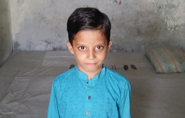 Zain Ali PreOp Pics (2) aa