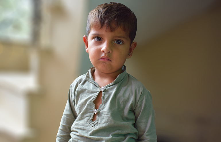 Abdul Hadi PreOp Pics (13)aa