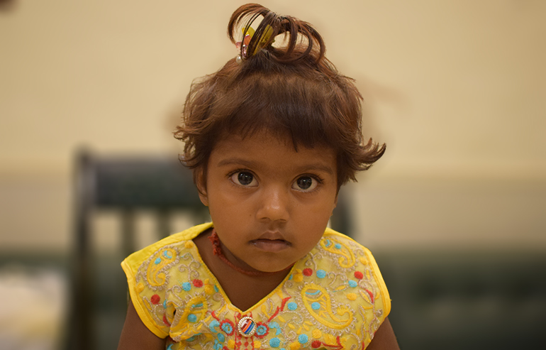 Fatiam Zahid PreOP Pics (2) a