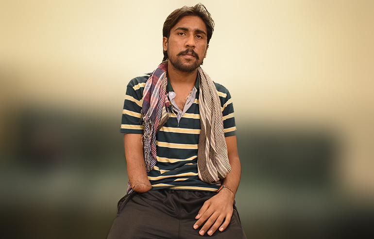 Kashif Shahzad PreOp Pics (6) a