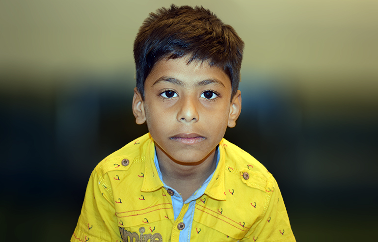 Muhammad Abbas PreOp Pics (5) aa