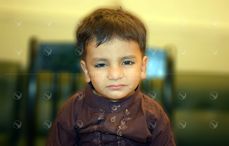 M. Sultan Raza PreOP Pics (7) aa
