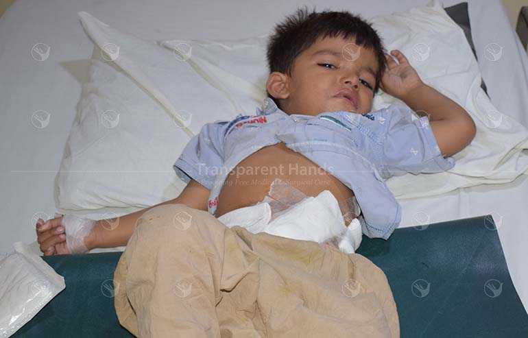Fazeel Shabir Ahmed PostOP Pics (5)