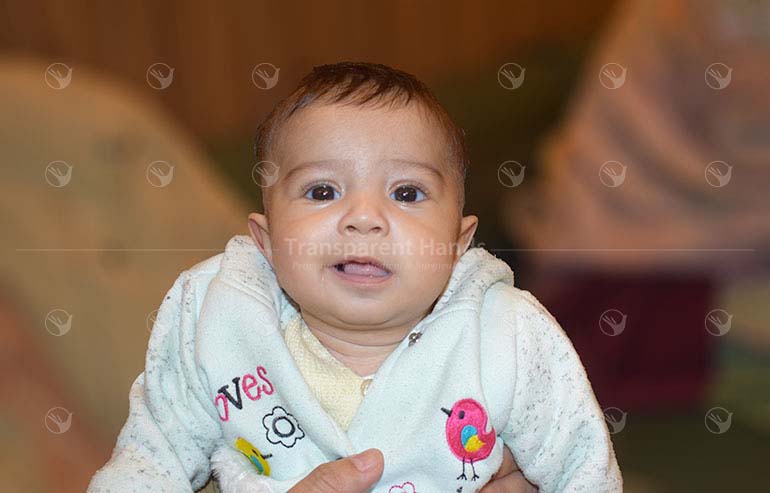 M. Hamdan PostOp Pics (1) aaa