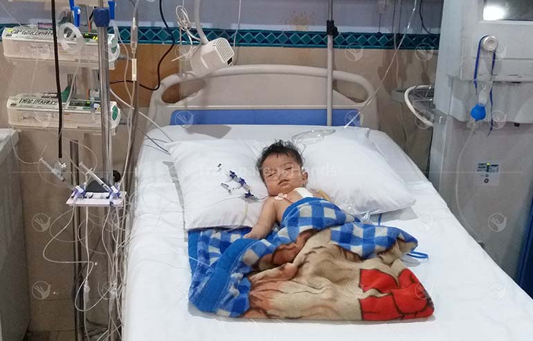 Muhammad Hamdan Post Op Pic’s (3) aa
