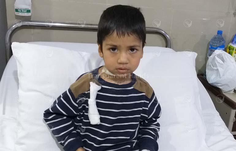Muhammad Maaz Post Op Pic’s (3) a