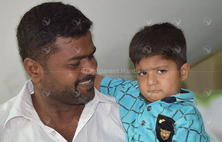 Ahil Abbas preOp Pics (7) a