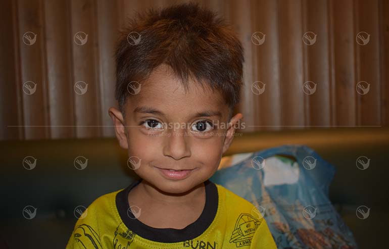 Arham Ali PreOp pics (2) a