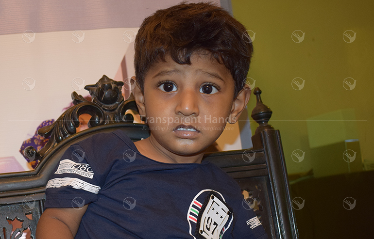 Muhammad Azhan preOp Pics (2) a