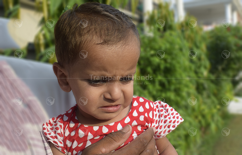 Zarwa hussain pre op pic 1 (12) a