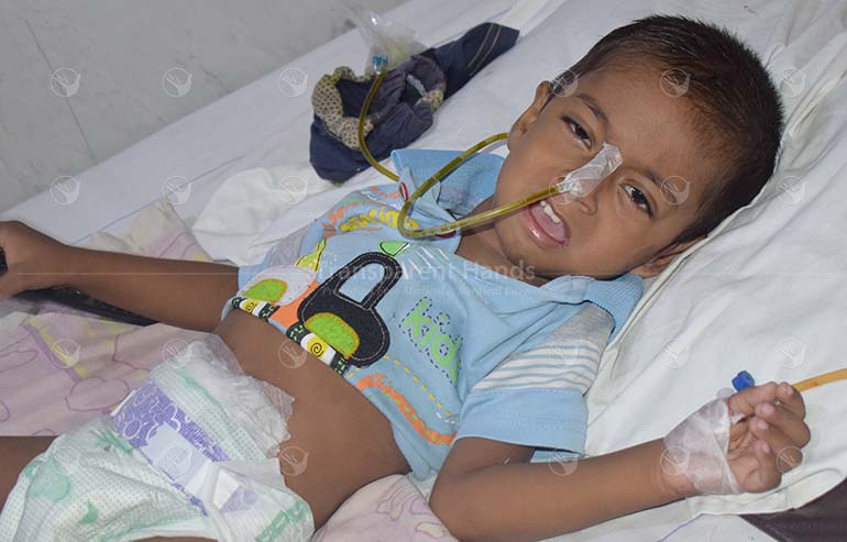 Arham Ali PostOP Pics 2nd surgery (2) a