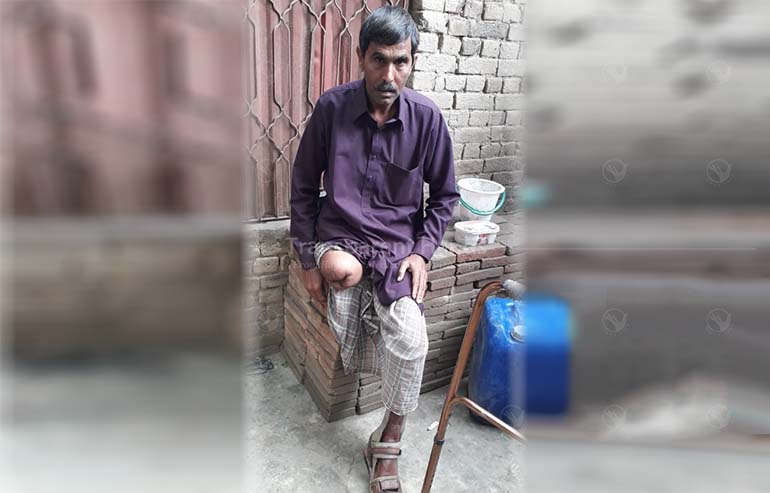 Donate to Munir Ahmad for His Leg Rehabilitation   