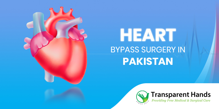 bypass surgery