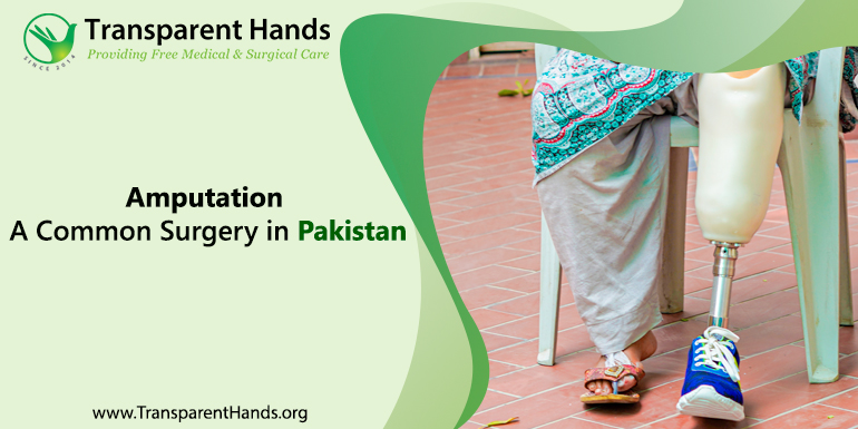 Amputation a common surgery in Pakistan
