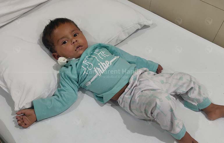 Abdul hadi Angiography and Open Heart Surgery