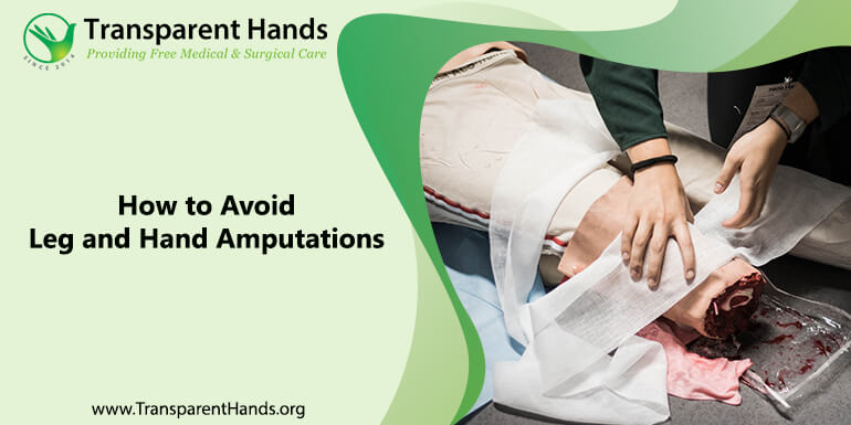 Amputations