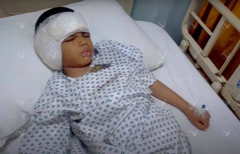Abdul Manan cochlear implant surgery
