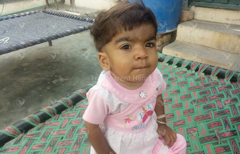 Amna Bibi Pre Op