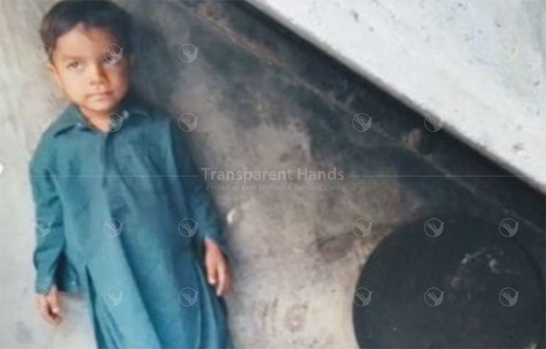 Owais pre image