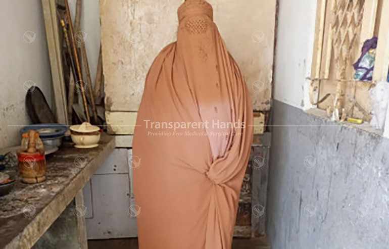 Shera Bibi Cholecystitis patient pre image