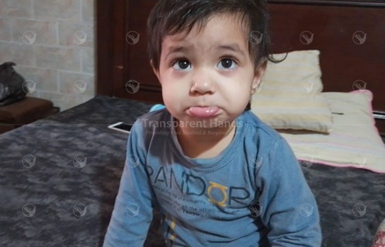 Rania’s Cochlear Implant