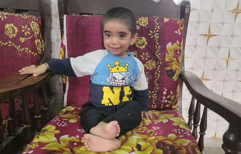 Farhan Pre Op (3)
