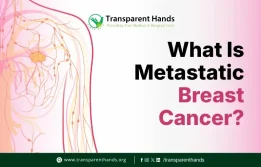 Metastatic Breast Cancer