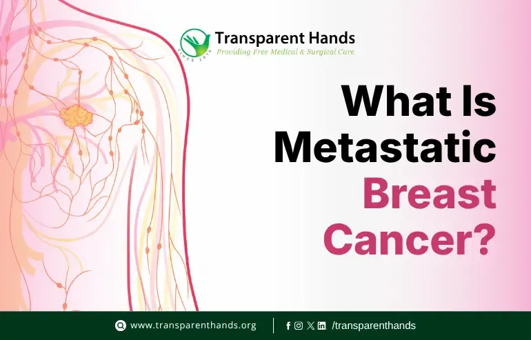 Metastatic Breast Cancer