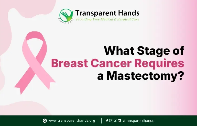 Stage of Breast Cancer